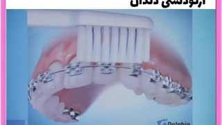 ارتودنسی ارزان در تهران