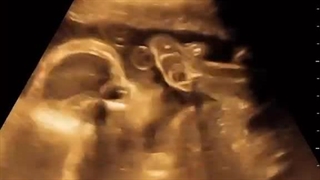 حرکت جنین در ماه های آخر بارداری- حرکت خیلی آرام و ملایم