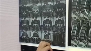 جراحی دیسک و تنگی کانال کمری - دکتر یزدان پناهی جراحی فک