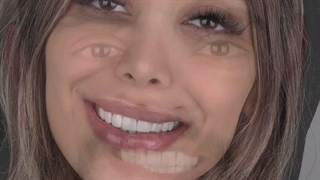 لبخندی زیبا با جرمگیری دندان