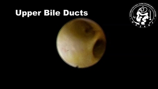 کلدوکوسکوپی حین عمل کله سیستکتومی لاپاروسکوپیک